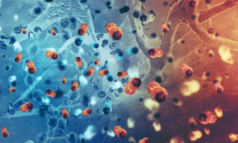 İkinci peritoneal xərçəngi nədir?